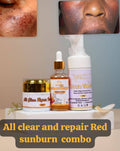 ALL CLEAR AND REPAIR RED SUNBURN COMBO